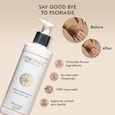 VEDICDERM Natural Psoriasis Cream for Dry Itchy Skin Steroid-Free Formula with Ayurvedic Herbs Helps Soothe Redness, Flakiness & Irritation Moisturizing Body Cream for Sensitive Skin (200ml Pack of 2)